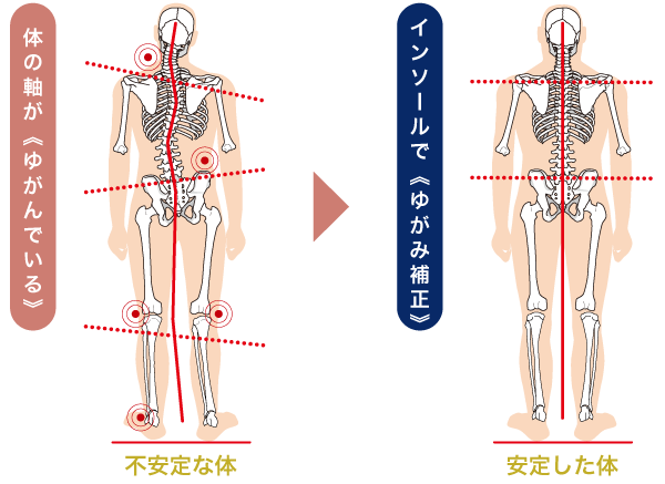 姿勢矯正インソール健美足 | 有限会社レーベル