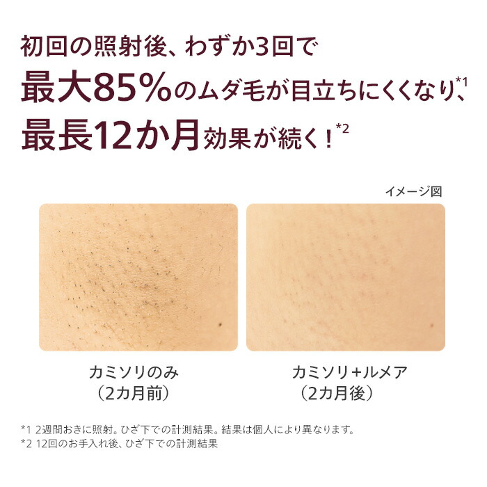 楽天市場】光美容器 フィリップス ルメア アドバンス フラッシュ式