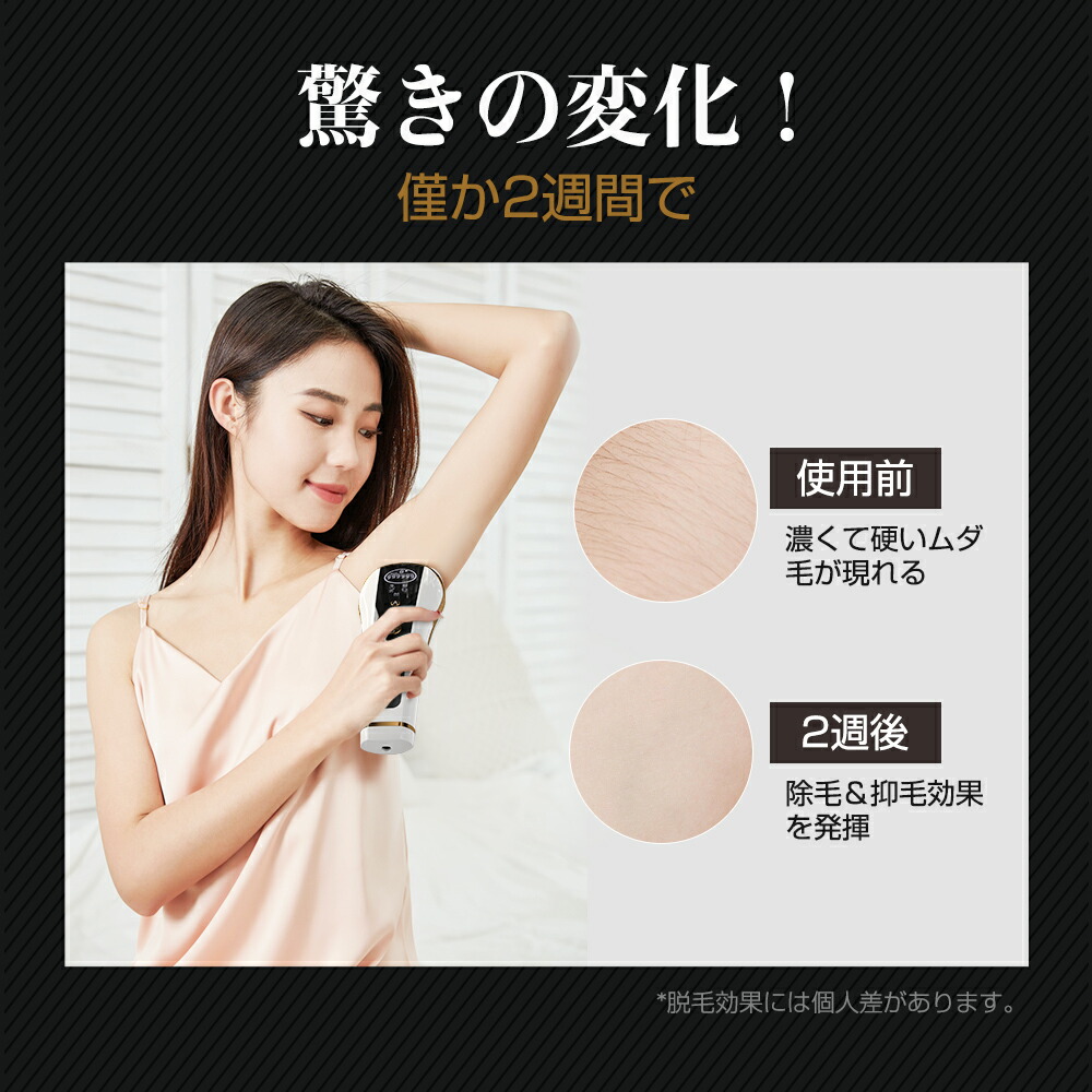 楽天市場】＼クーポンで6,582円☆SS限定！／次世代HIPL脱毛 脱毛器