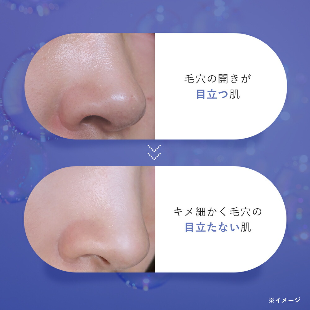 楽天市場】美白 薬用 美容液 夜用フィス ホワイト医薬部外品 美白美容