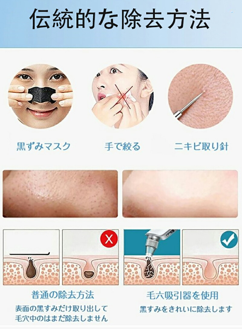 楽天市場】美顔器 毛穴吸引器 角栓吸引 毛穴吸引 いちご鼻 黒ずみ 毛穴