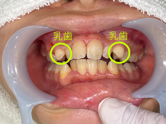 矯正歯科・矯正治療 - 上田デンタルクリニック（菖蒲池駅）
