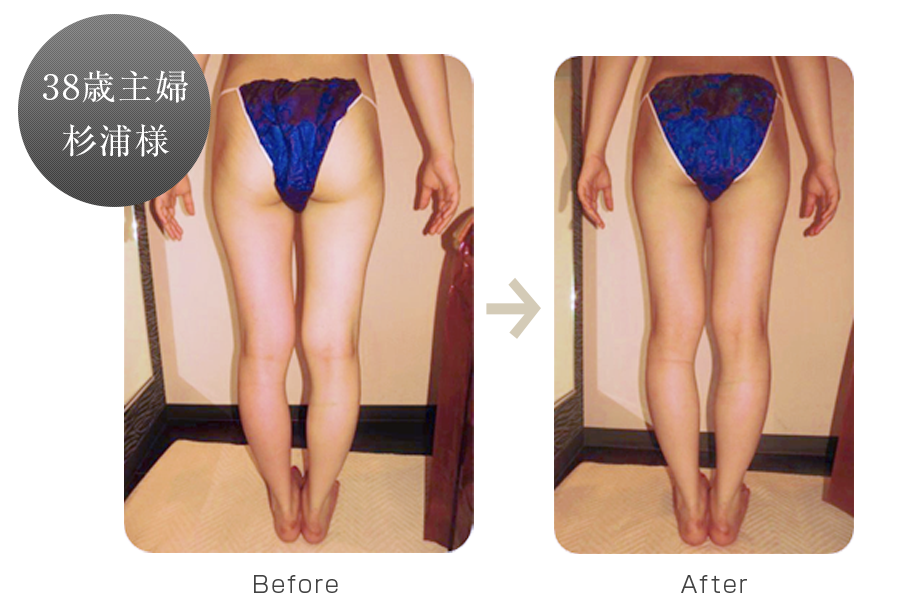 株式会社ワムのハイパーシェイプ®