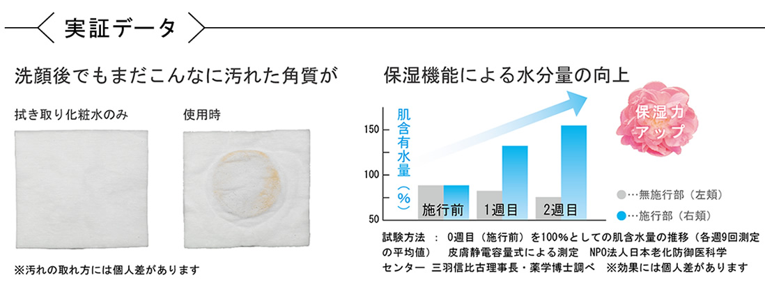 超音波美顔器 KBE-1120/P｜エステアイテム｜フェイスケア｜ビューティ