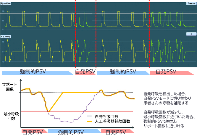 人工呼吸器 MONNAL T60 ベンチレータ 「新機能にズームイン！」｜医療