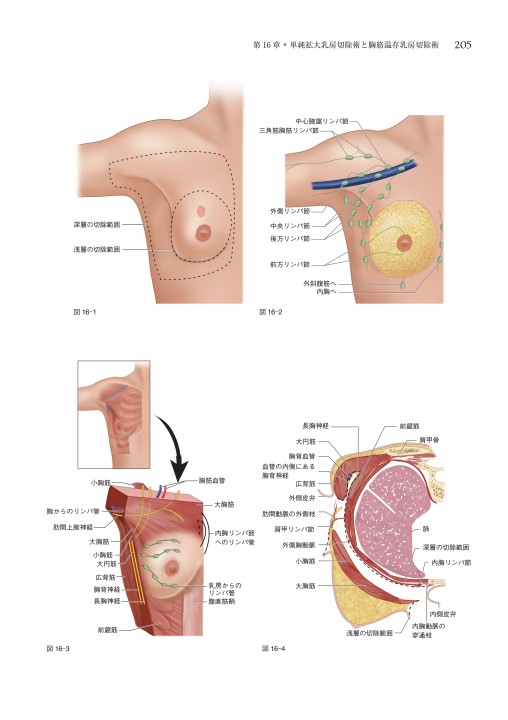 乳腺外科手術アトラス_立ち読み