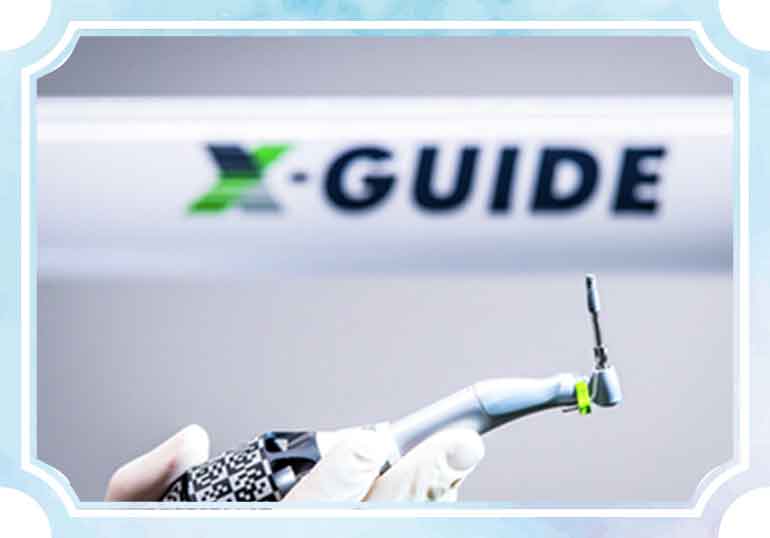 X-ガイド(エックスガイド) | 池田歯科クリニック