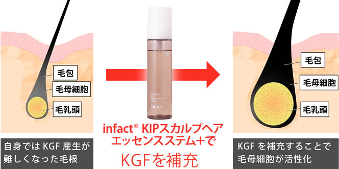 男性向け】KIPスカルプヘアエッセンス｜AGA・薄毛治療の【聖心毛髪再生