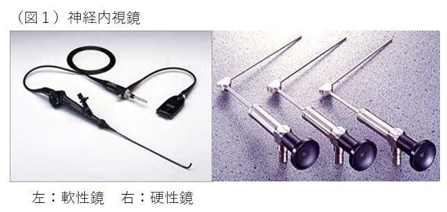 神経内視鏡手術 | 診療科・部門 | 済生会横浜市南部病院