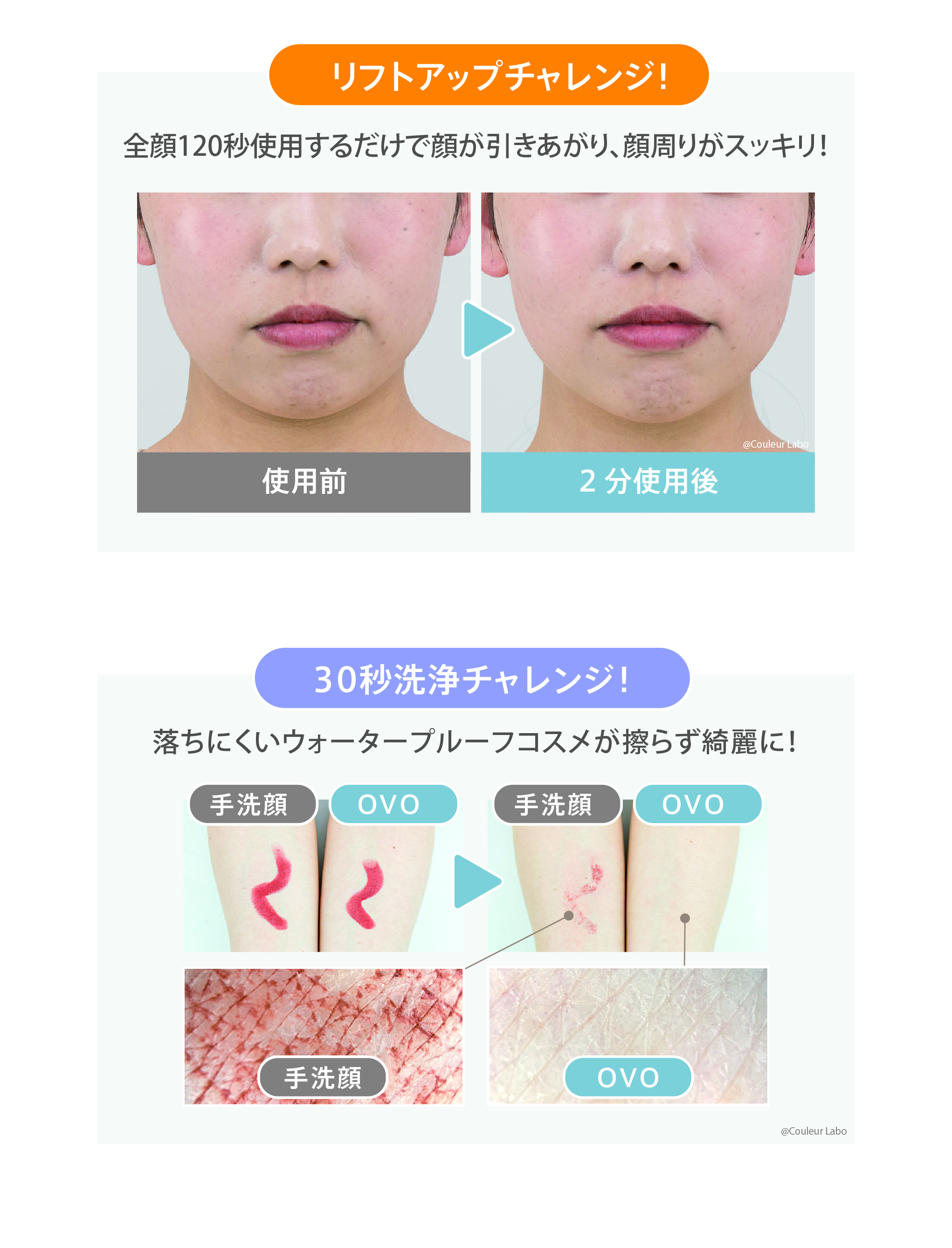 ZOGANKIN OVO（ゾーガンキン オーヴォ) |EMSと音波振動でリフトアップ