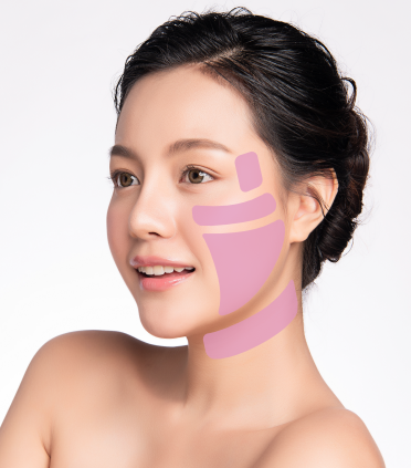 次世代医療用HIFU（ハイフ）で エイジングケア。「ベレーザプロ」導入