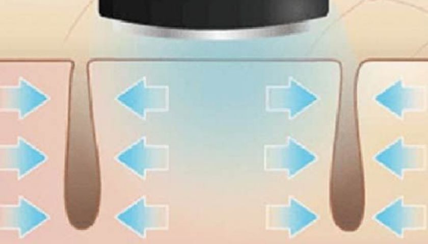 HAKEI（ハケイ）」あなたの毎日に合わせて進化するAI美顔器｜YA-MAN