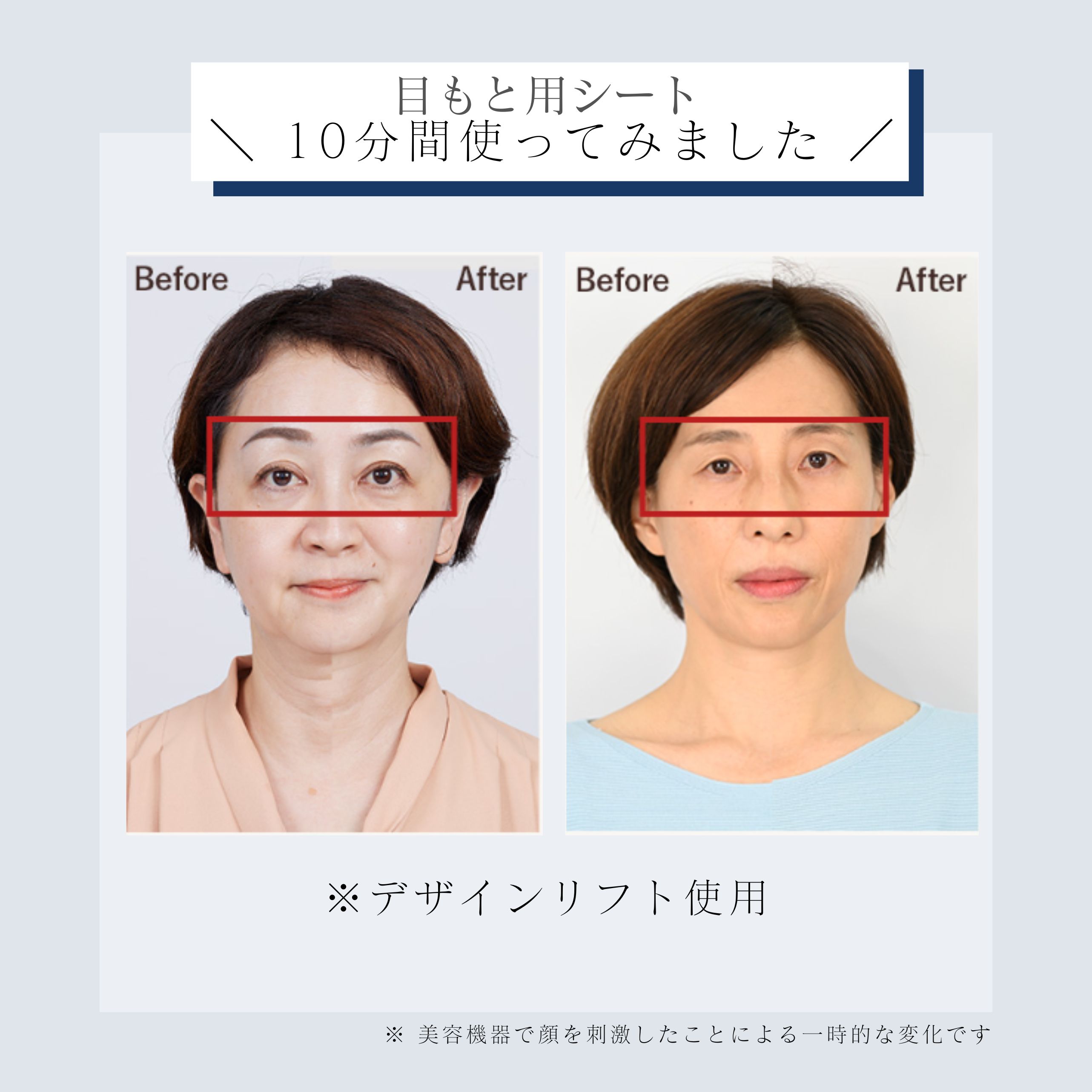 デザインリフトモア目もと＆口もとWケア4ヵ月コースD（C1）｜ヤーマン