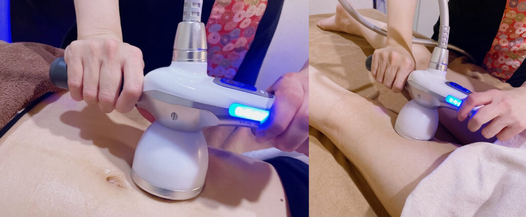 固まったセルライトに即効性の結果をもたらすキャビテーション – 大阪