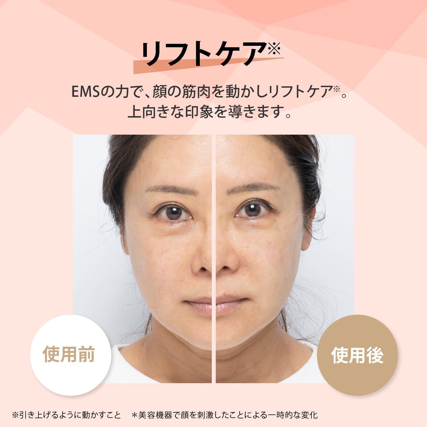 月額7,880円レンタルプラン：ヤーマン フォトプラス シャイニーネオ