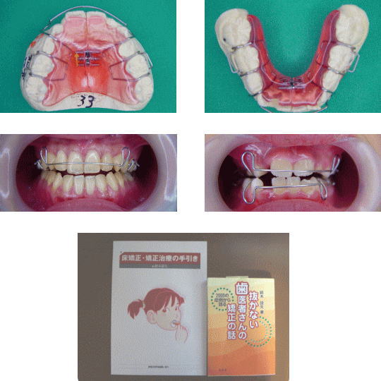 床矯正｜ひご歯科医院