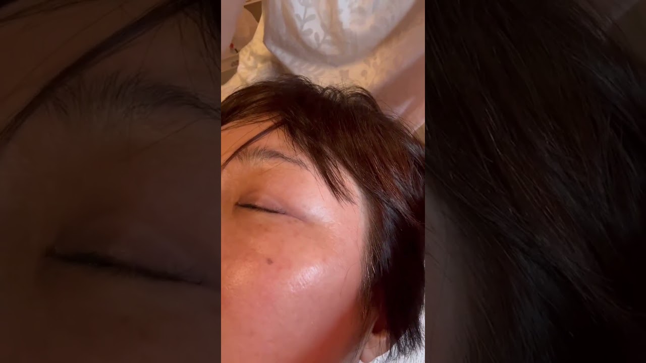 Pure Radiance (ピュアラディアンス) | 業務用シミケアマシン