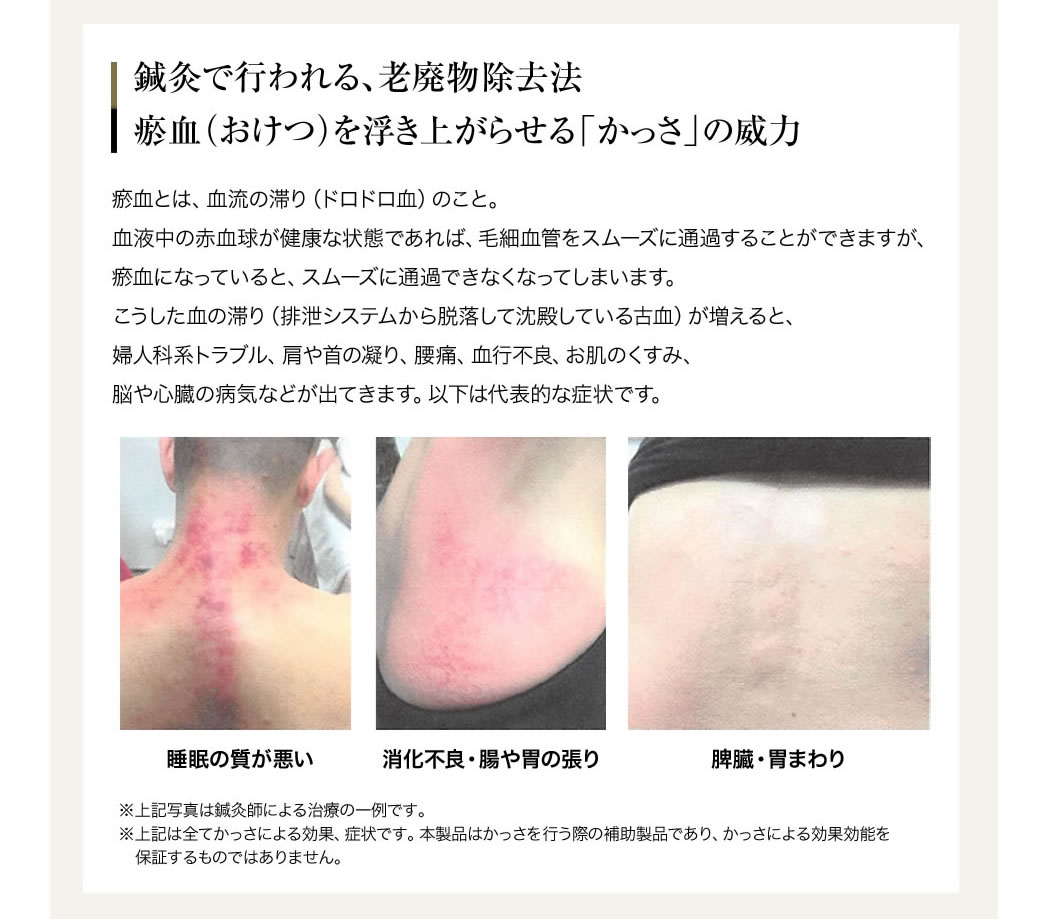 楽天市場】【専用オイル1本&さらにプレゼント♪】経絡温熱美容器 HEAT