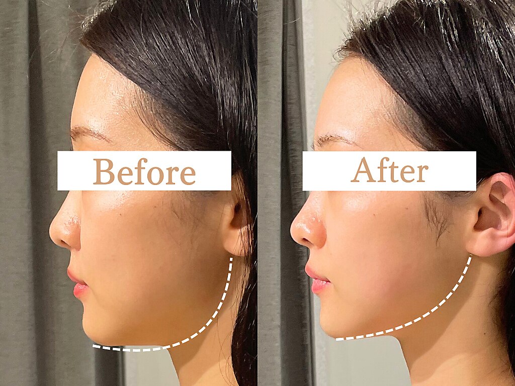 フローフシ∞｜ホットペッパービューティー