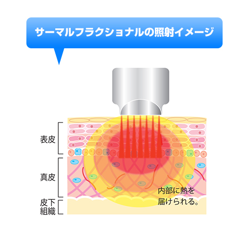 BE-BE（ビービー） | エステ業務用美容機器販売の株式会社L.H.B