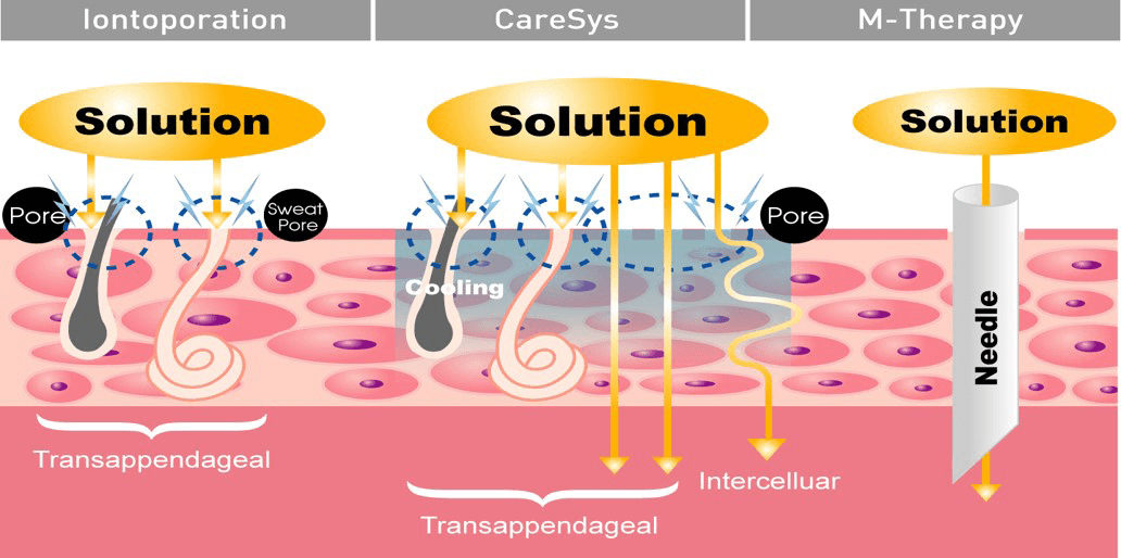 ケアシス 〜エレクトロポレーション導入法｜福岡 美容皮膚科 松田知子