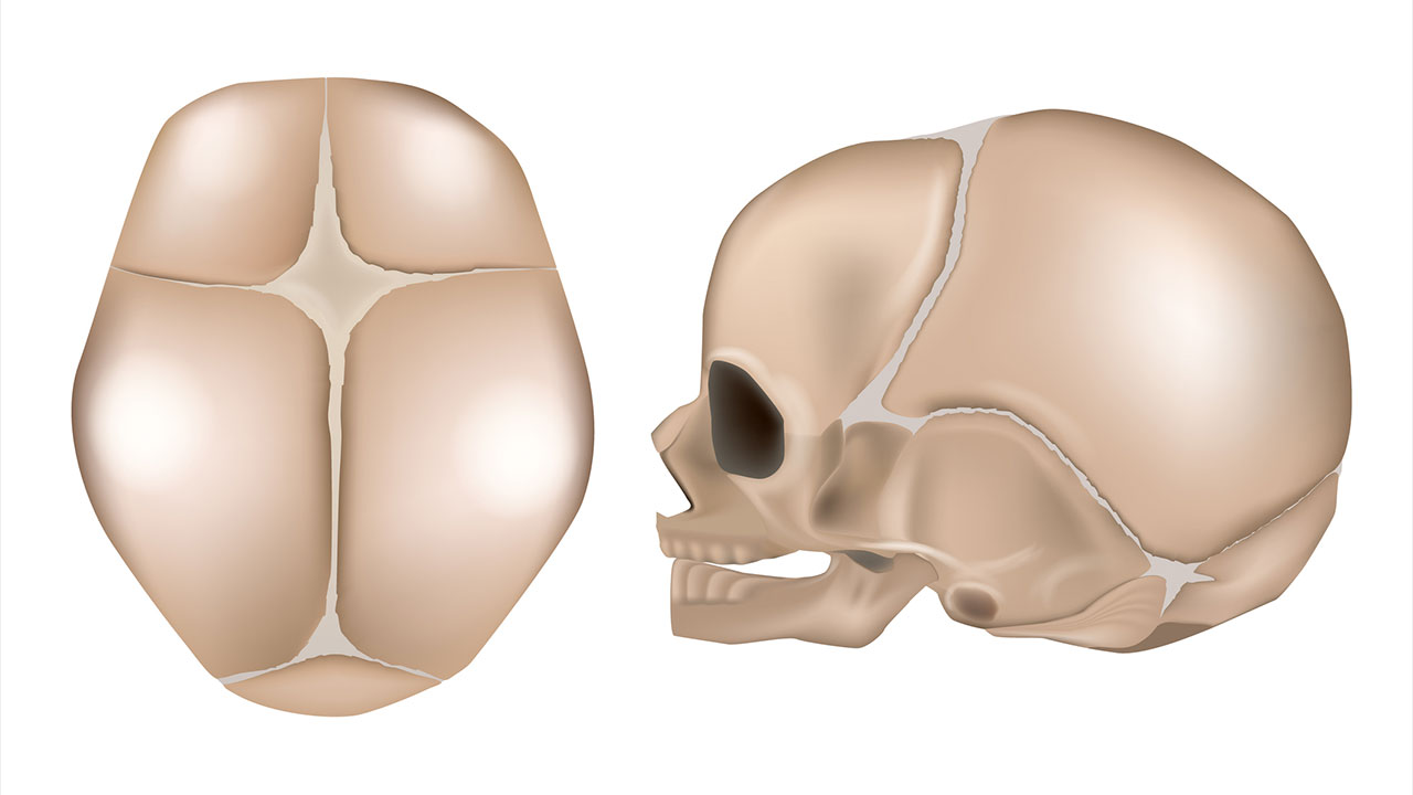 頭蓋骨縫合早期癒合症 | 病気と治療の検索サイト「メディカルブレイン」