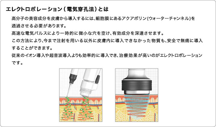 エレクトロポレーション｜高津駅前なかしま皮ふ科クリニック｜高津区