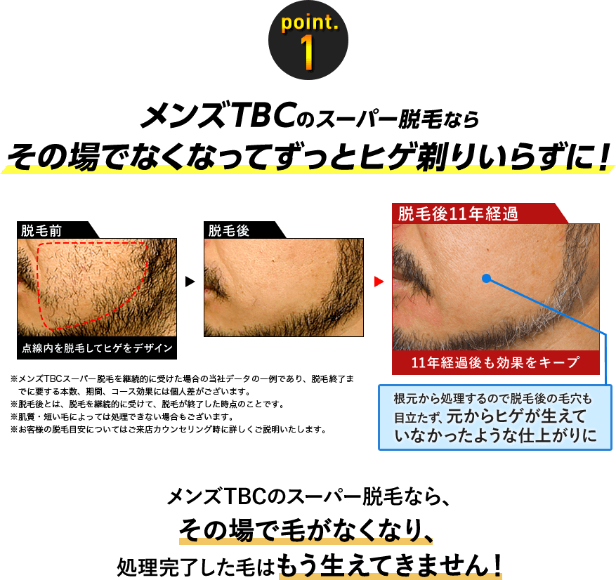 メンズTBCの脱毛料金、予約方法、効果、口コミを紹介｜ヒゲ脱毛は