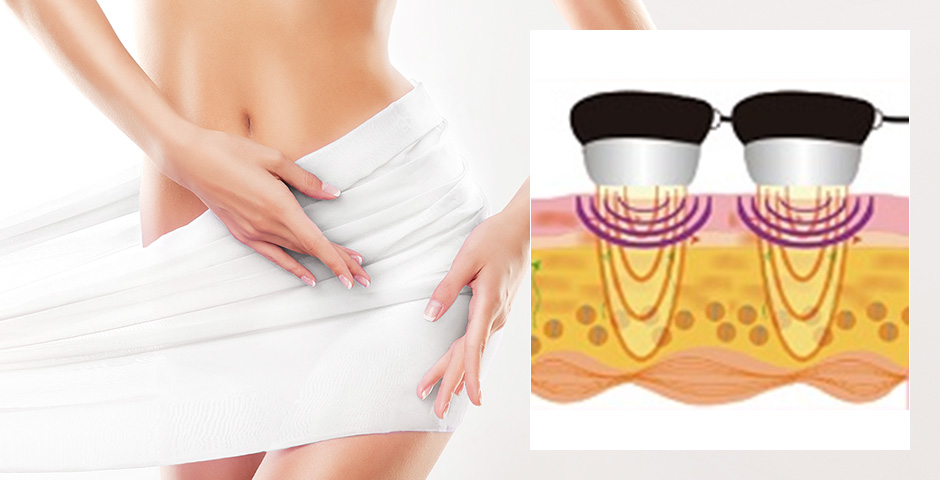 キャビマックスパーフェクション｜ダイエットエステならセルライト撃退