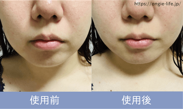 NEWAリフトプラスを体験してみた！口コミ通りの効果はある？ - ANGIE