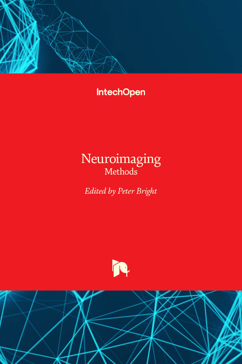 Neuroimaging - Methods | IntechOpen