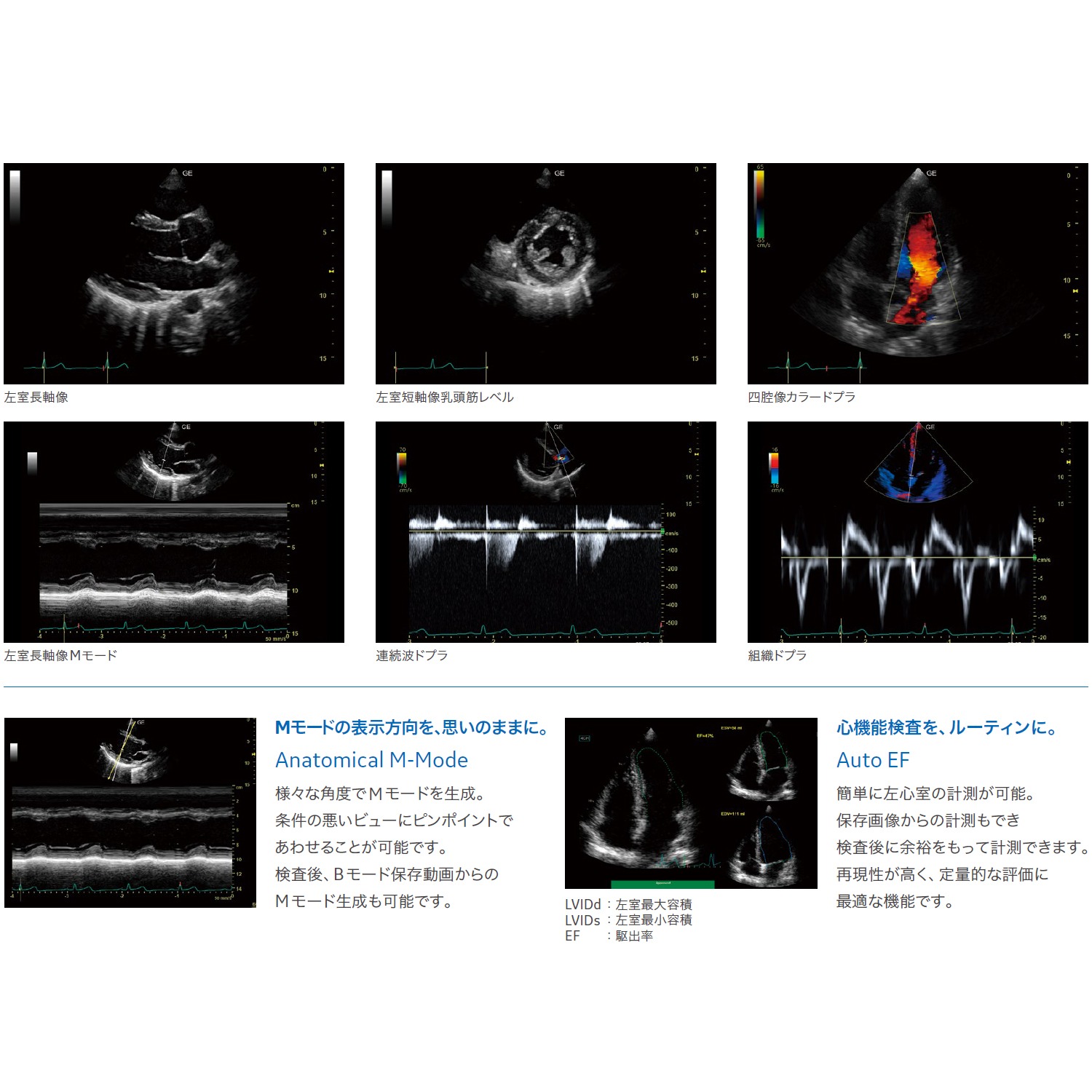 Versana Premier | 映像情報Medical