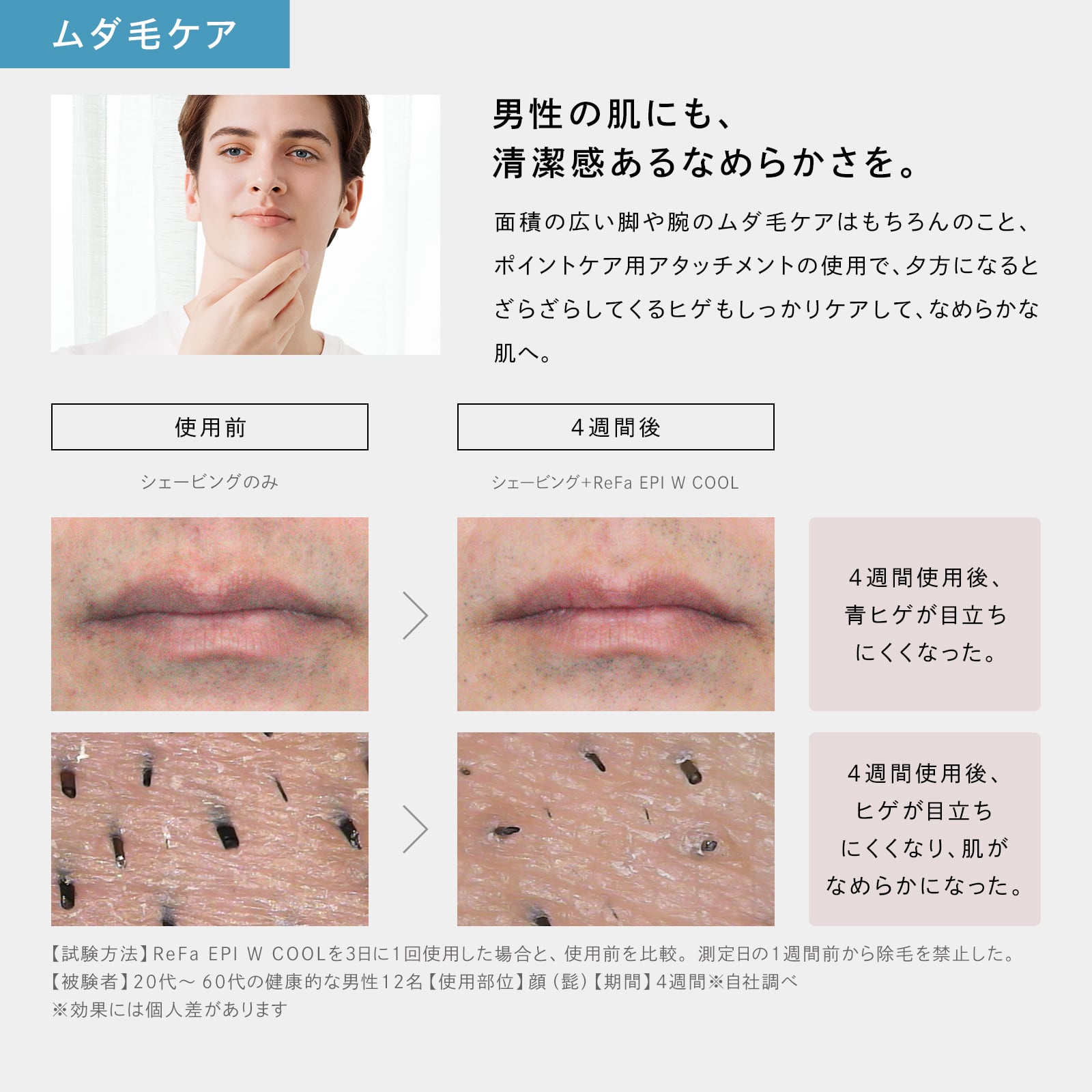 リファエピダブル クール 光美容器 VIO ヒゲ 顔 脇 ワキ メンズ: MTG